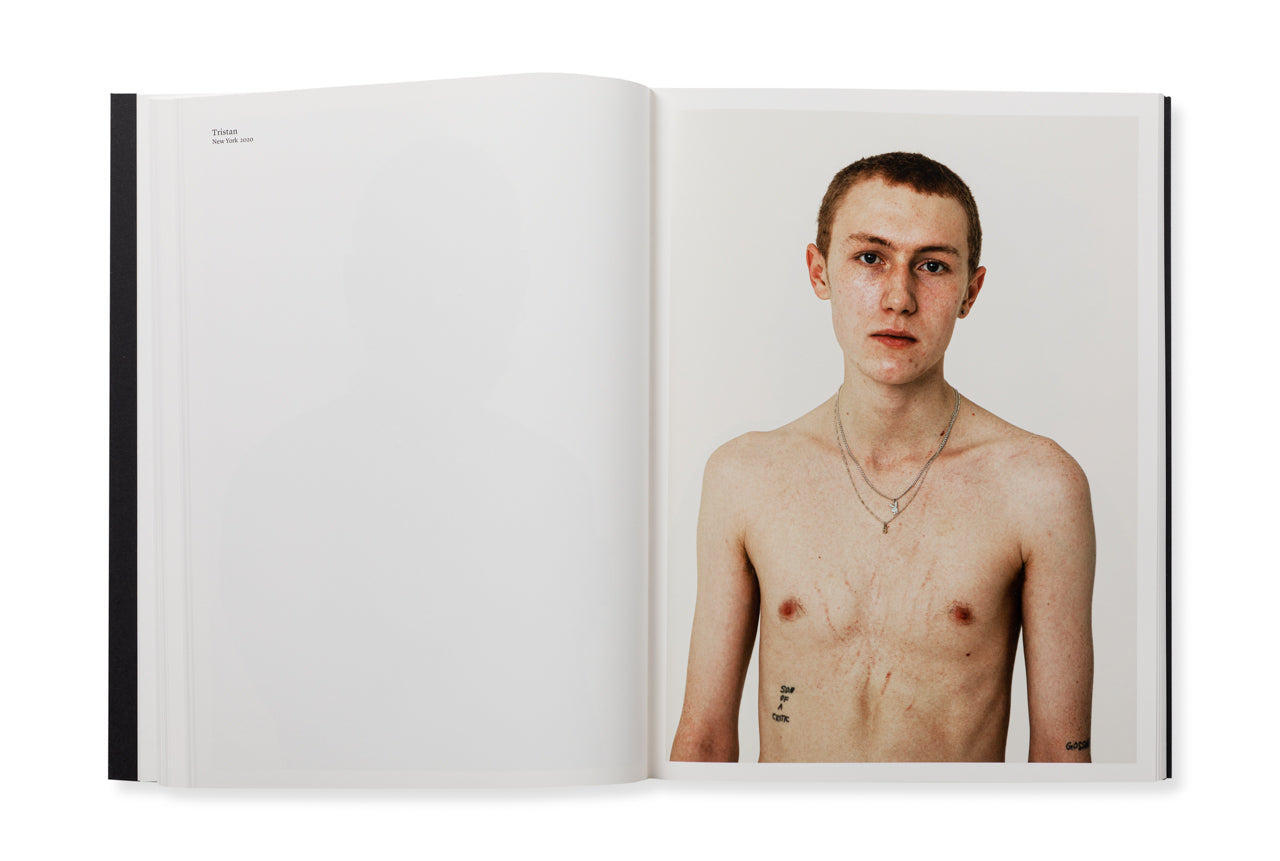 Pieter Hugo / Solus Vol. I. Concerning Atypical Beauty and Youth